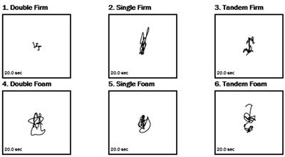 A novel method of assessing balance and postural sway in patients with hypermobile Ehlers-Danlos syndrome